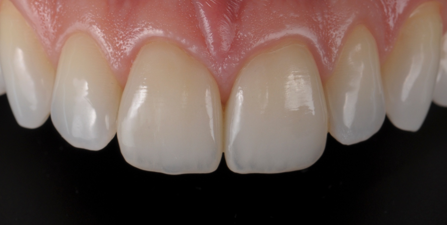 Photos Portfolio Gil Tirlet "La dent naturelle "-16.jpg