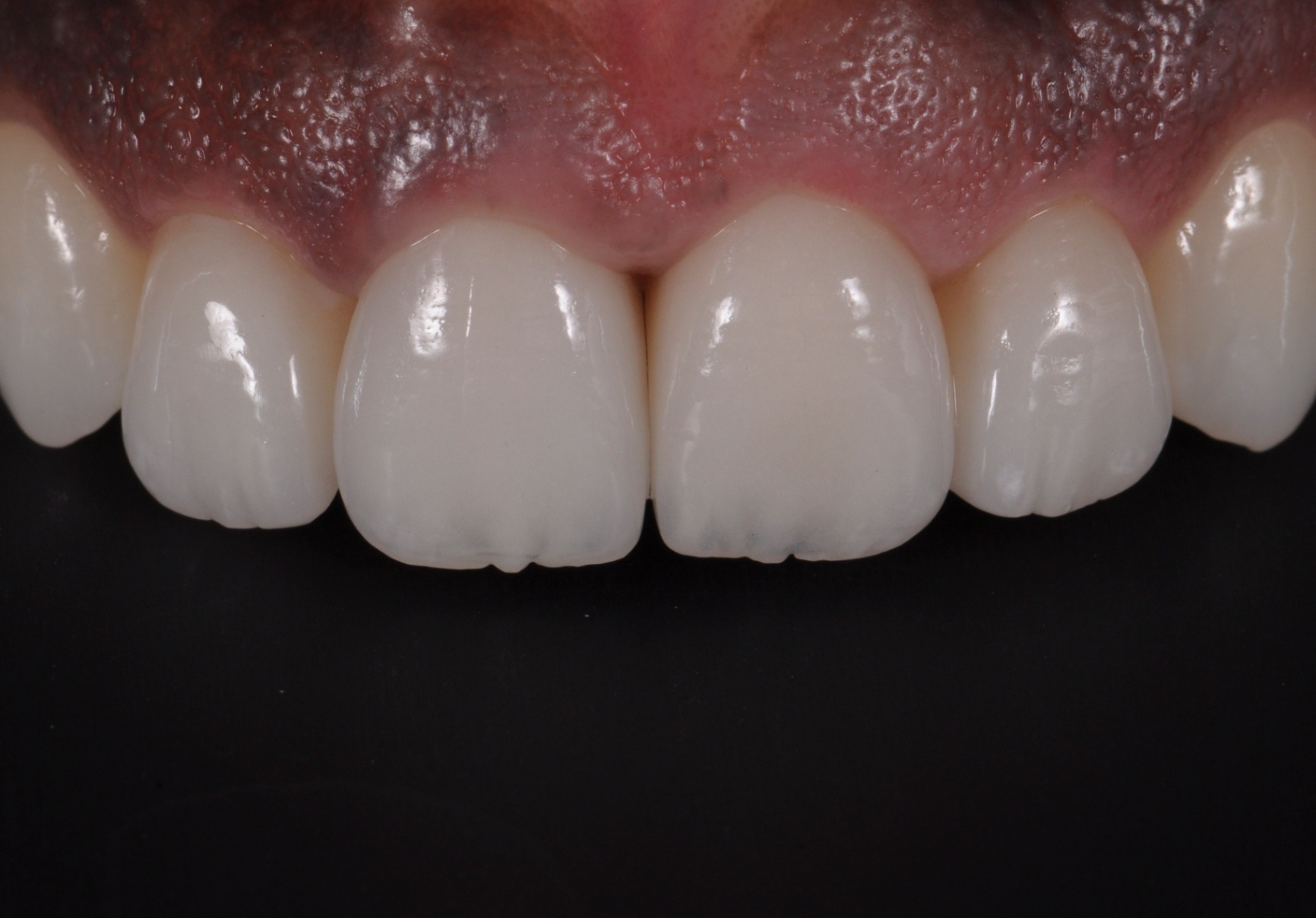 Photos Portfolio Gil Tirlet "La dent naturelle "-19.jpg