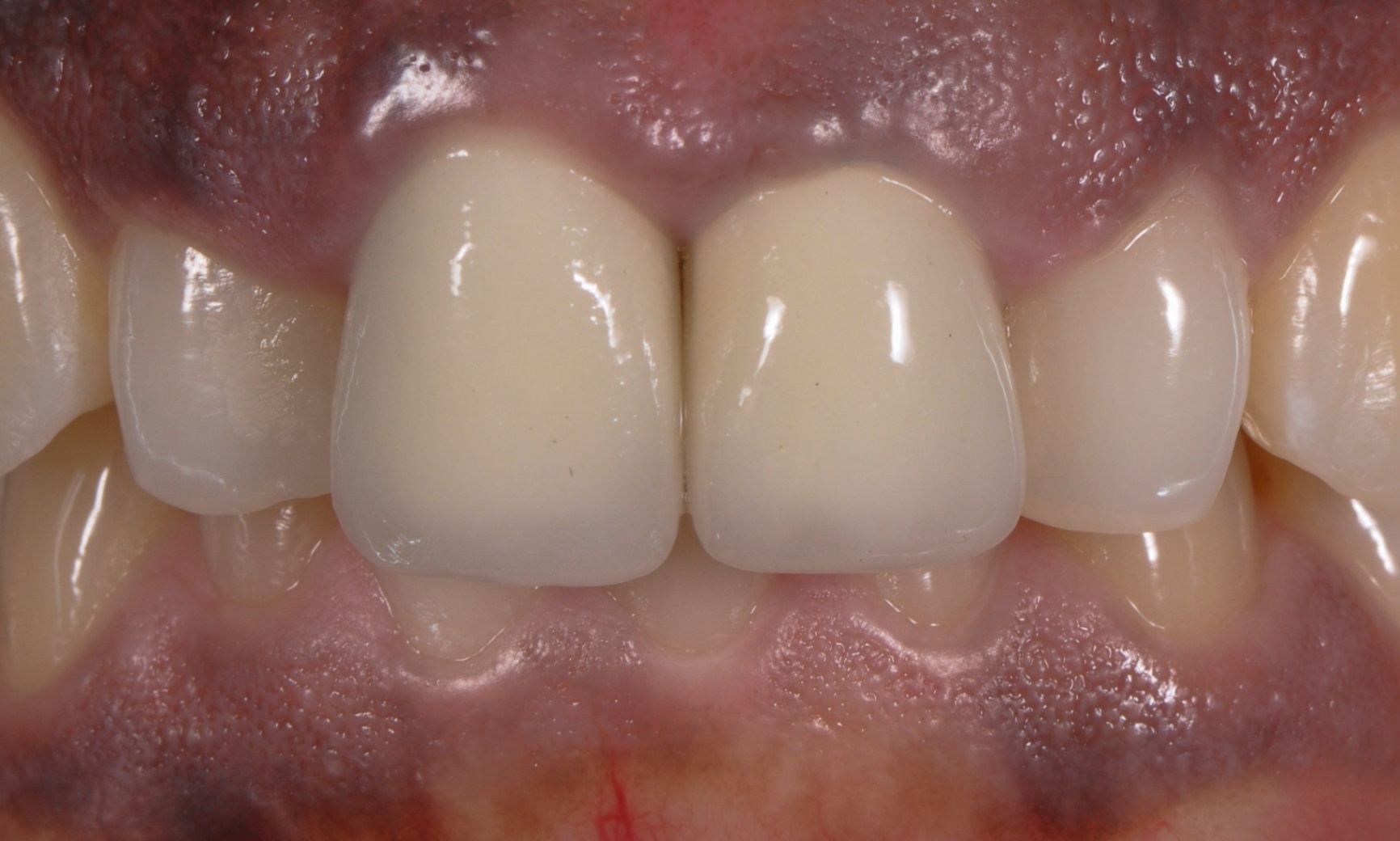 Photos Portfolio Gil Tirlet "La dent naturelle "-18.jpg