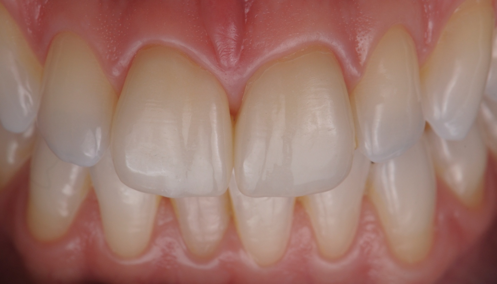 Photos Portfolio Gil Tirlet "La dent naturelle "-17.jpg