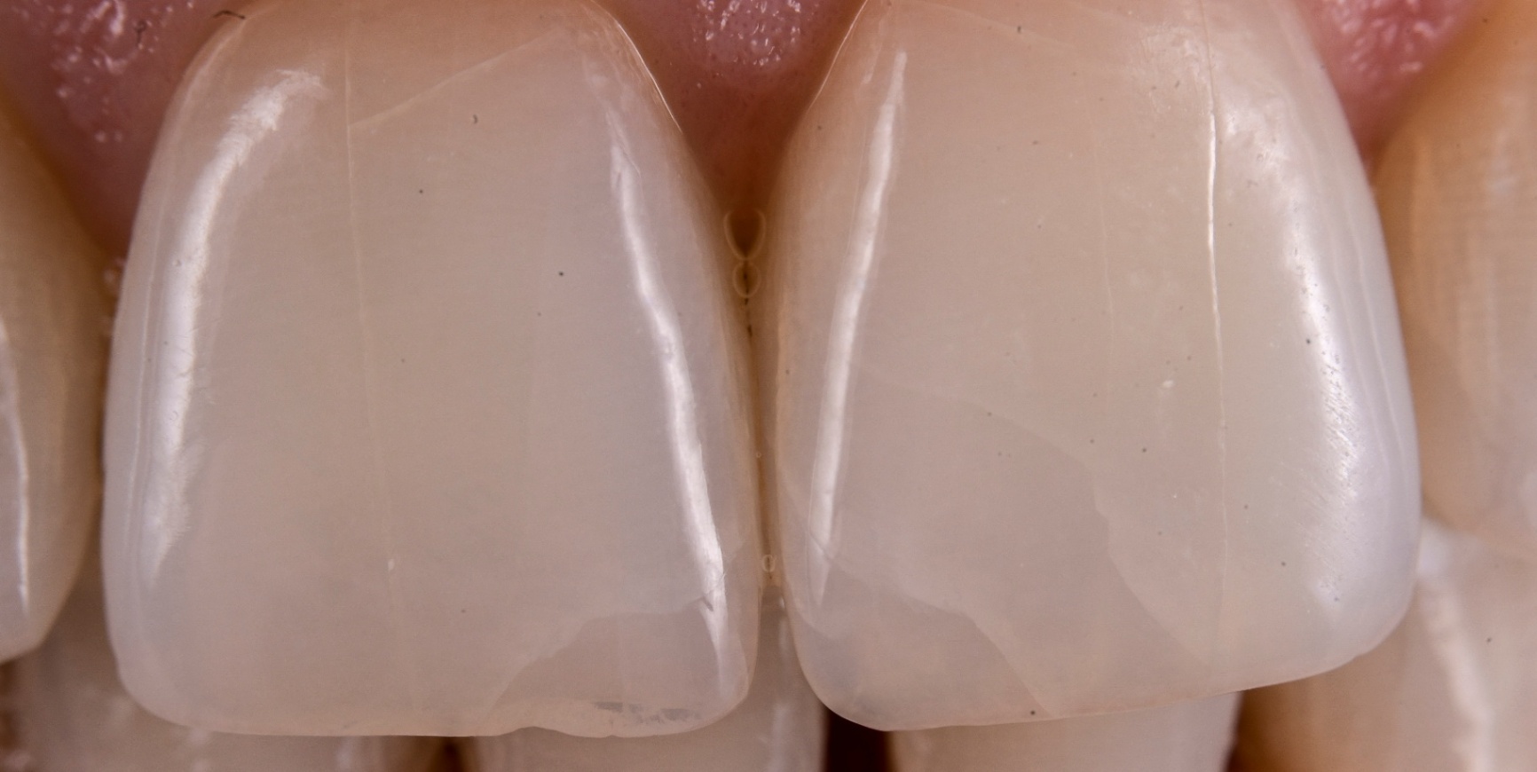 Photos Portfolio Gil Tirlet "La dent naturelle "-8.jpg