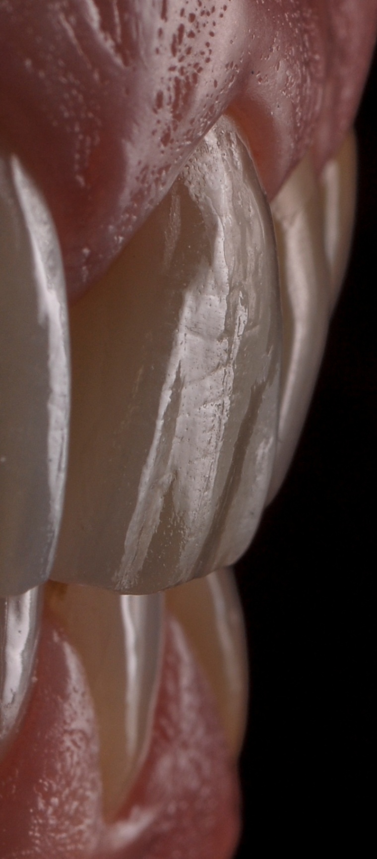 Photos Portfolio Gil Tirlet "La dent naturelle "-20.jpg