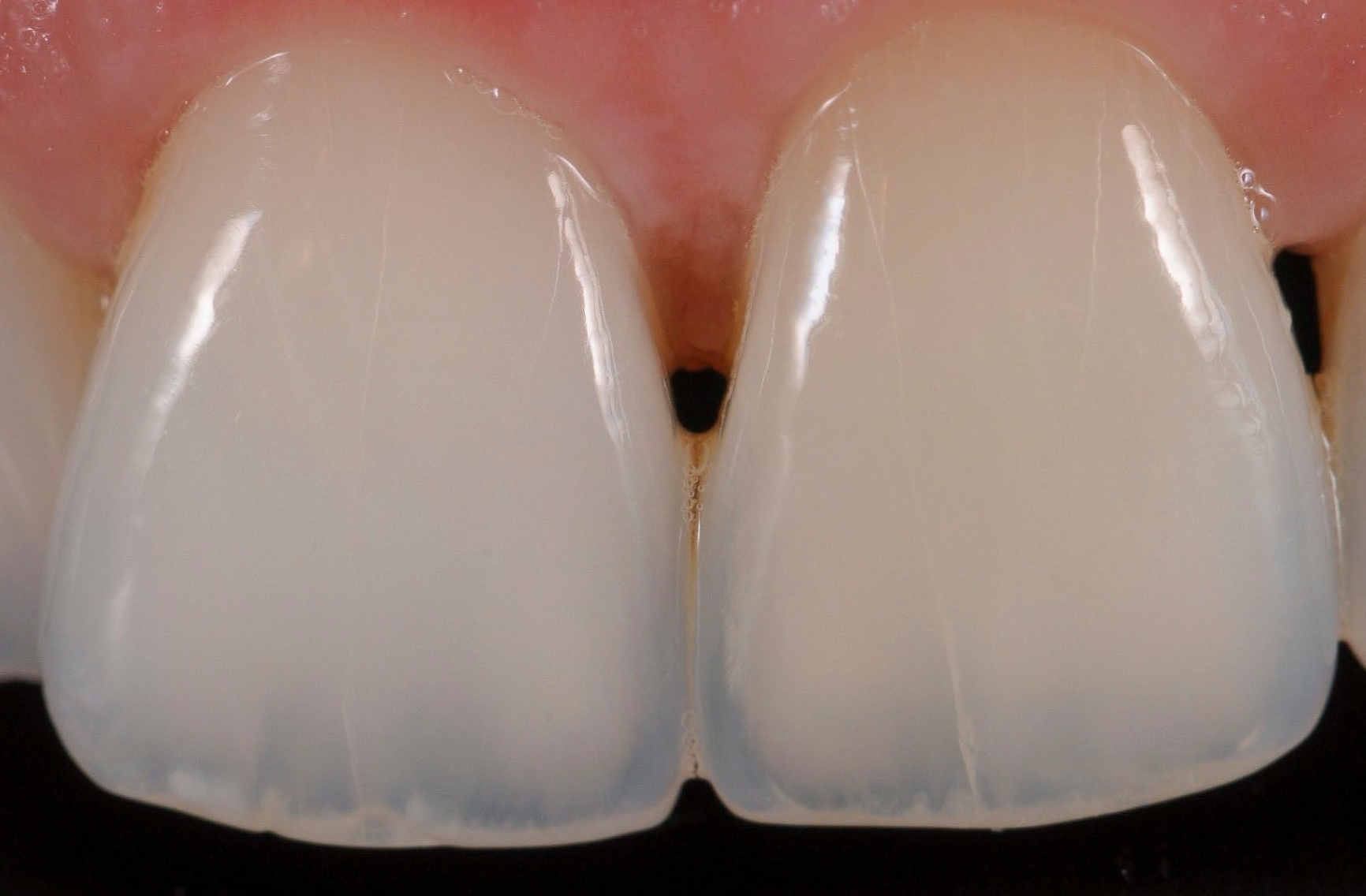 Photos Portfolio Gil Tirlet "La dent naturelle "-3.jpg