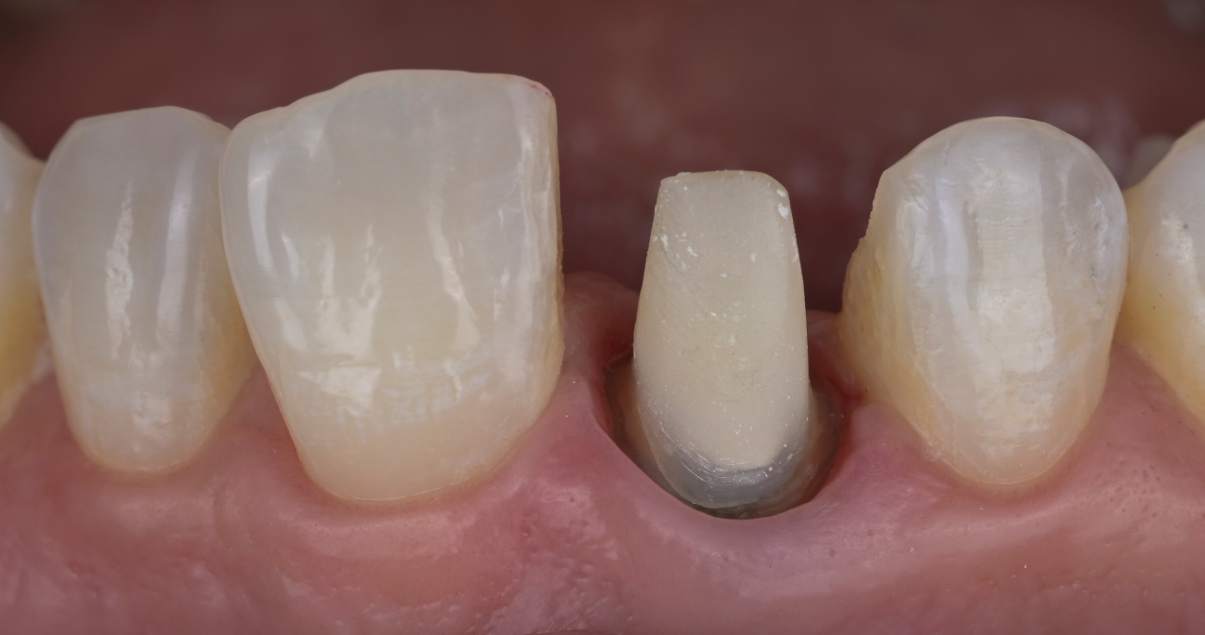 Photos Portfolio Gil Tirlet "La dent naturelle "-13.jpg