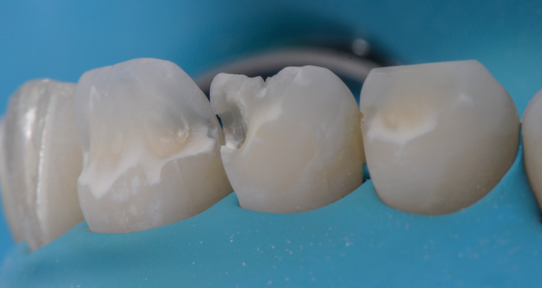 Photos Portfolio Gil Tirlet "La dent naturelle "-9.jpg