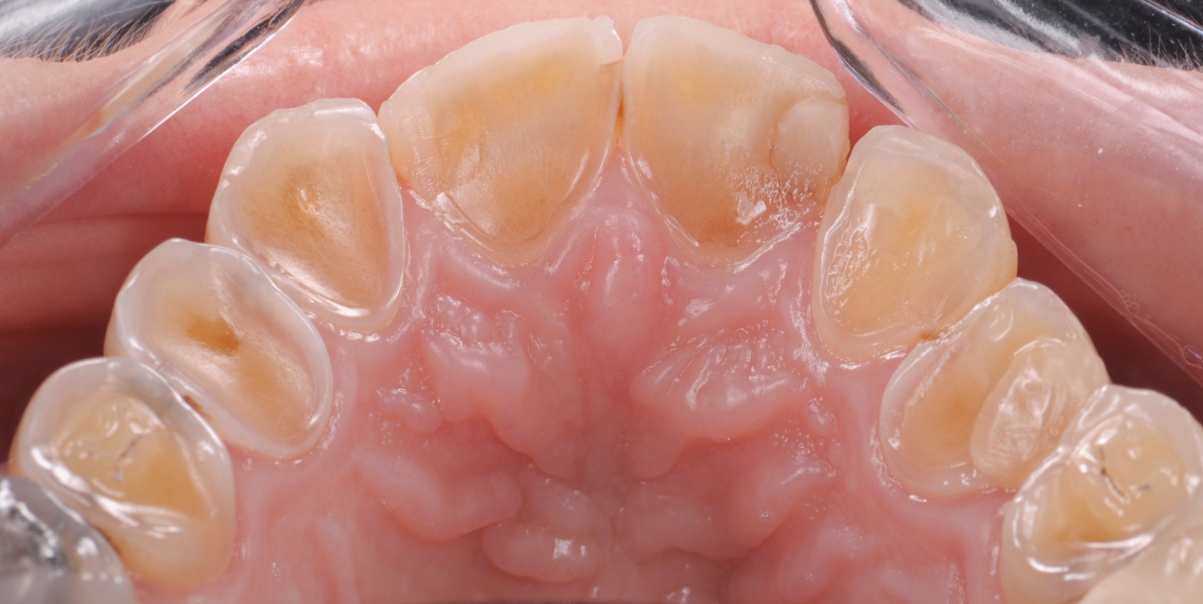 Photos Portfolio Gil Tirlet "La dent naturelle "-15.jpg