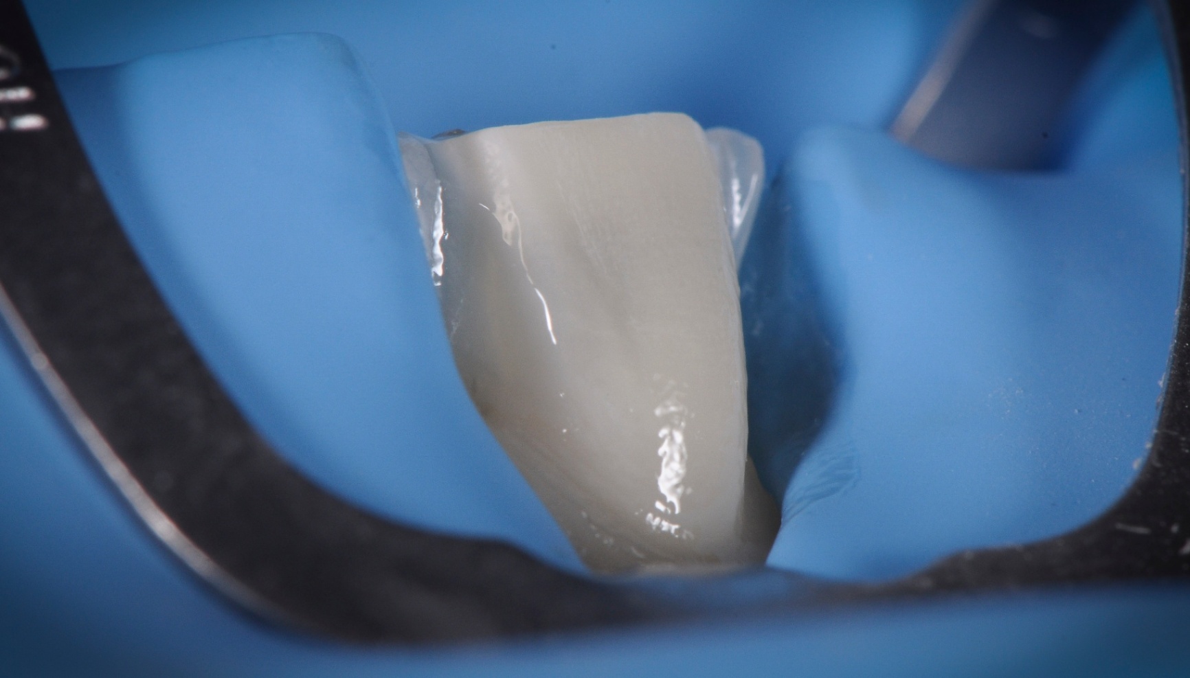 Photos Portfolio Gil Tirlet "La dent naturelle "-14.jpg