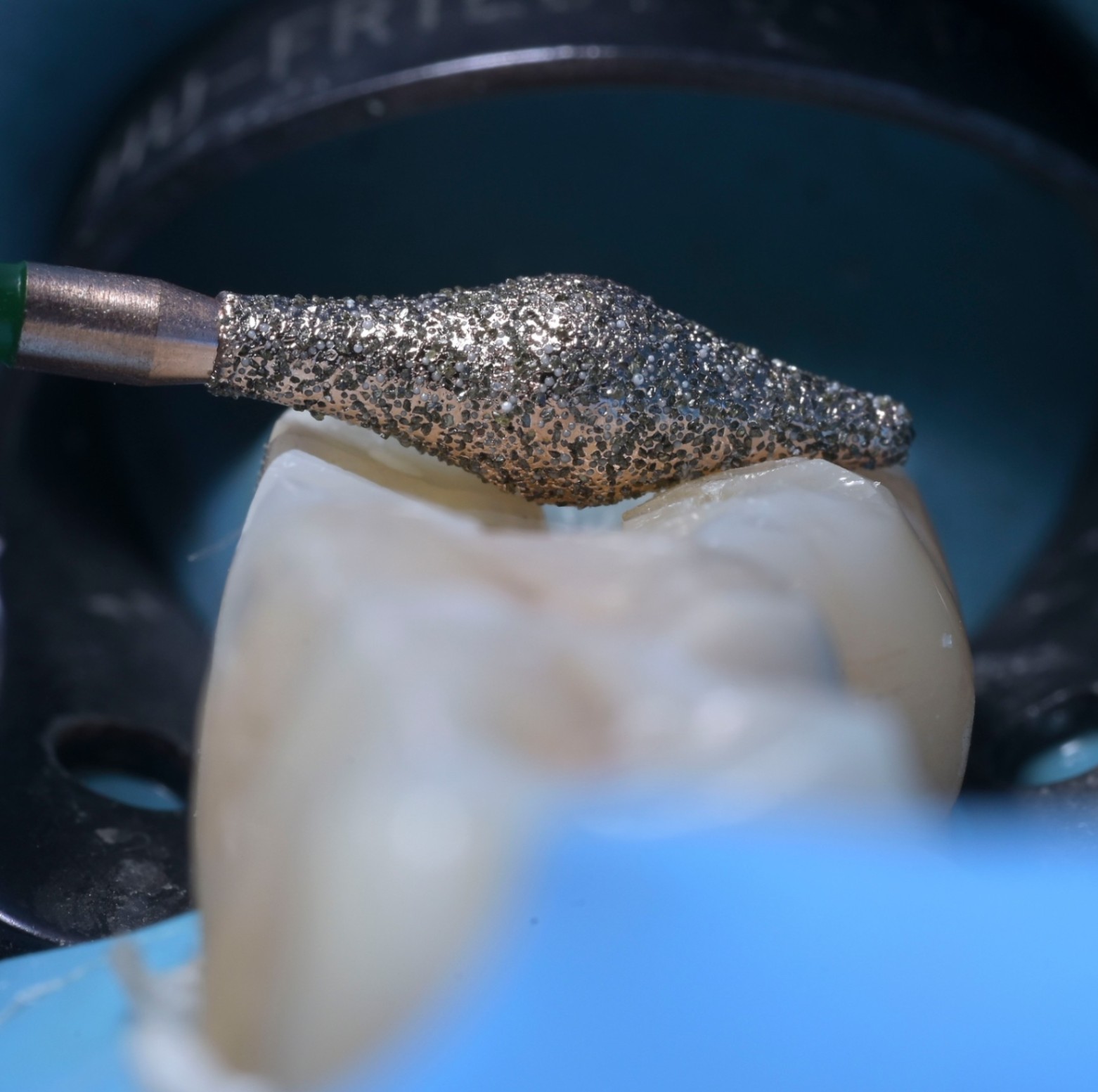 Photos Portfolio Gil Tirlet "La dent naturelle "-10.jpg